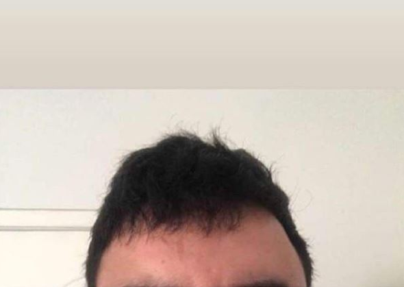 ชายคนนี้โพสต์รูปหน้าผากของตัวเองบน Instagram มาเป็นเวลา 6 ปี